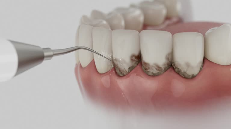 Reliable Dental Crowns And Bridges contractor in Brown County County, IN by Dentist Open Now
